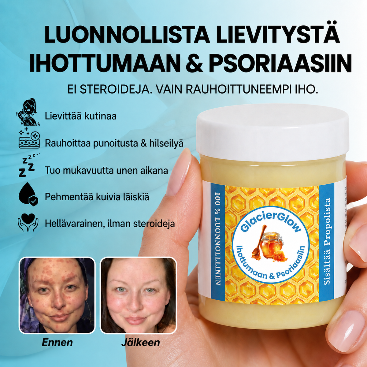 GlacierGlow™ | Pysäytä ihottuman & psoriaasin aiheuttama kutina ja rauhoita ärtynyt iho. Näkyvä vaikutus 14 päivässä!