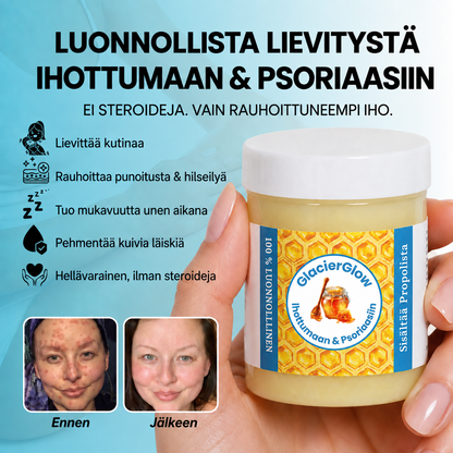 GlacierGlow™ | Pysäytä ihottuman & psoriaasin aiheuttama kutina ja rauhoita ärtynyt iho. Näkyvä vaikutus 14 päivässä!