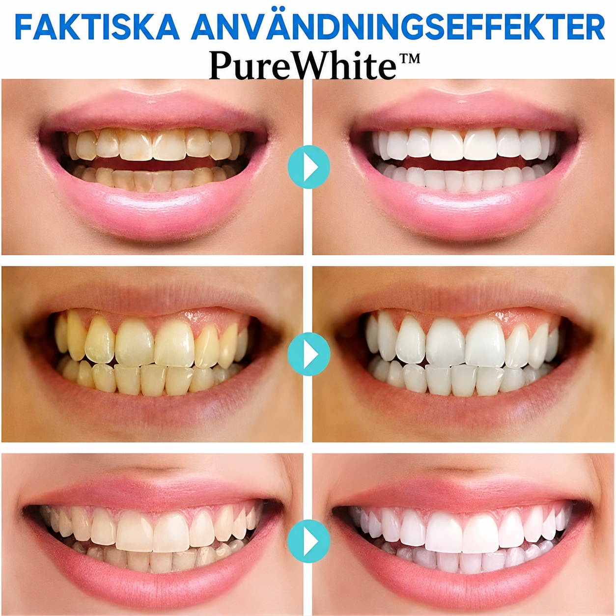 PureWhite™ | Valkaiseva hammastahna niasiiniamidilla – välitön vaikutus